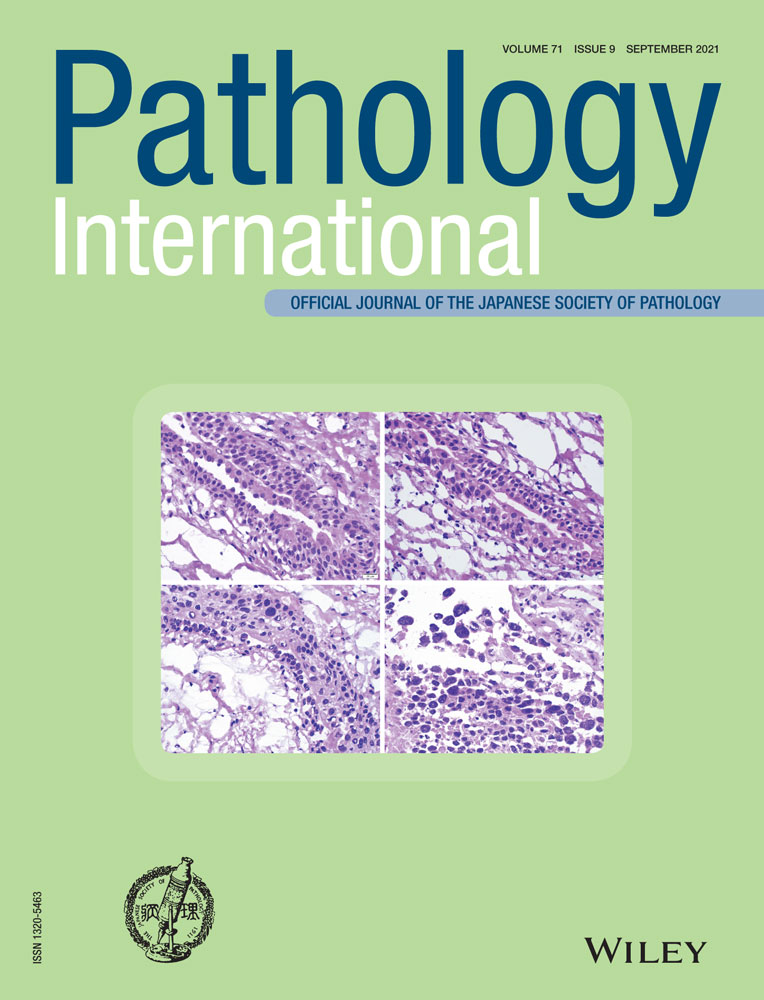 Investigation of the molecular causes underlying physical abnormalities in Diamond‐Blackfan anemia patients with RPL5 haploinsufficiency