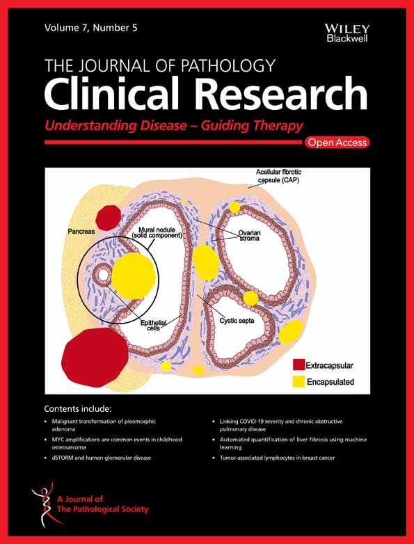 Characterizing the tumor microenvironment in rare renal cancer histological types