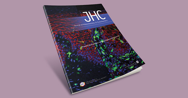The Conspicuousness of High Endothelial Venules in Angioimmunoblastic T-cell Lymphoma Is Due to Increased Cross-sectional Area, Not Increased Distribution Density