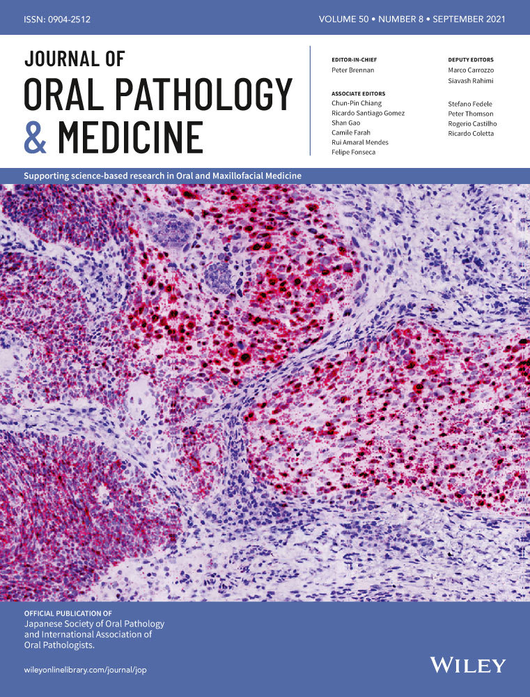 LncRNA LINC00152 promotes oral squamous cell carcinoma growth via enhancing Upstream Transcription Factor 1 mediated Mitochondrial Ribosomal Protein L52 transcription