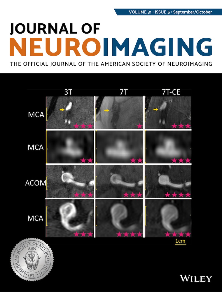 The central vein sign in multiple sclerosis lesions: Susceptibility relaxation optimization from a routine MRI multiecho gradient echo sequence