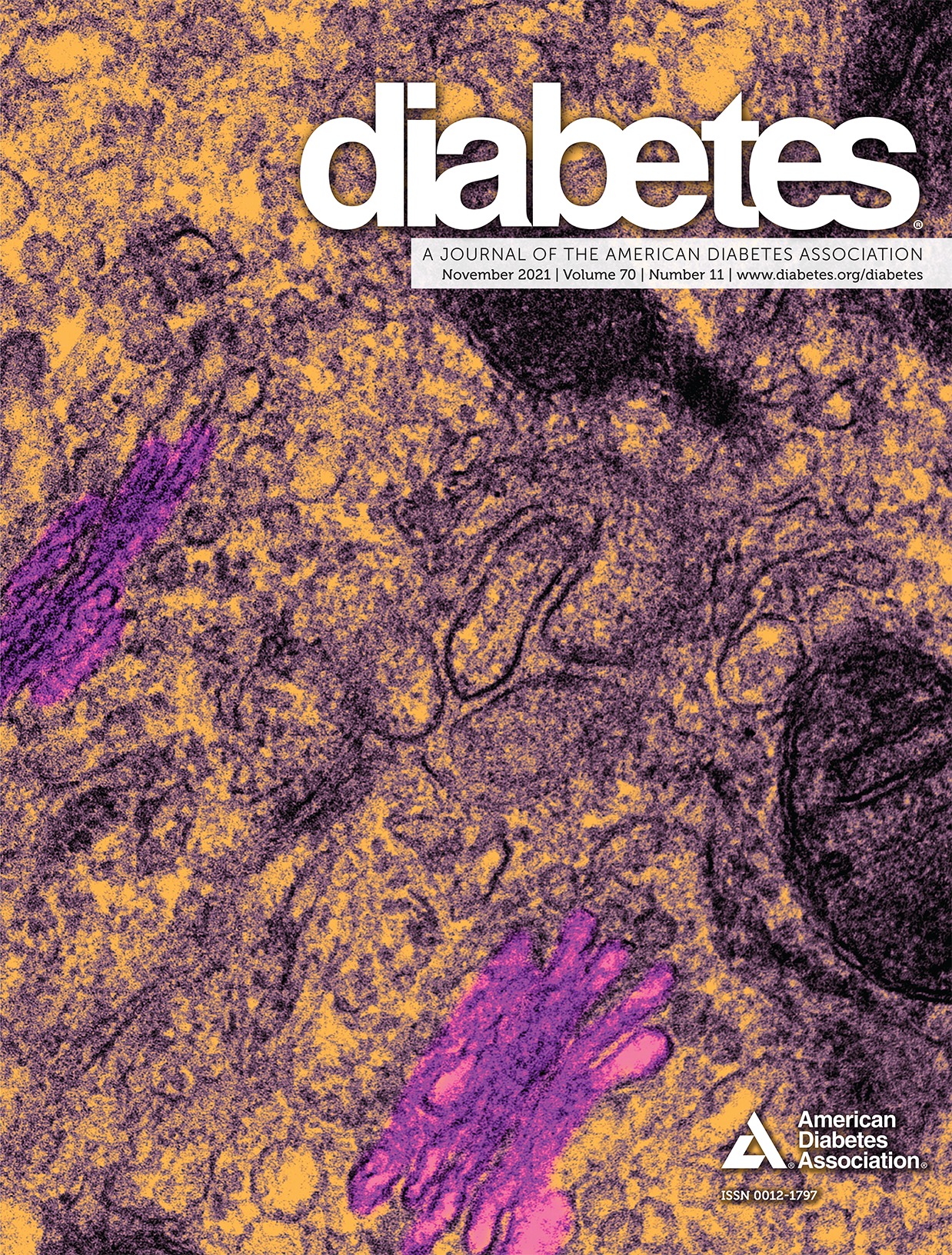 Critical Role for Hepatocyte-Specific eNOS in NAFLD and NASH