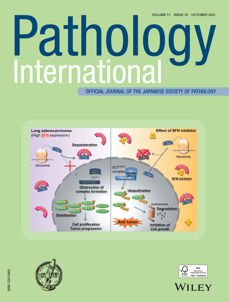 Post‐mortem differential diagnosis from COVID‐19: A case of fulminant myocarditis HHV‐6 related