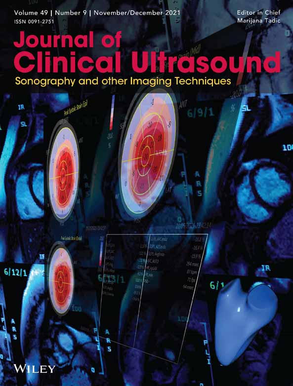 Seeing the unseen with superb microvascular imaging: Ultrasound depiction of normal dermis vessels
