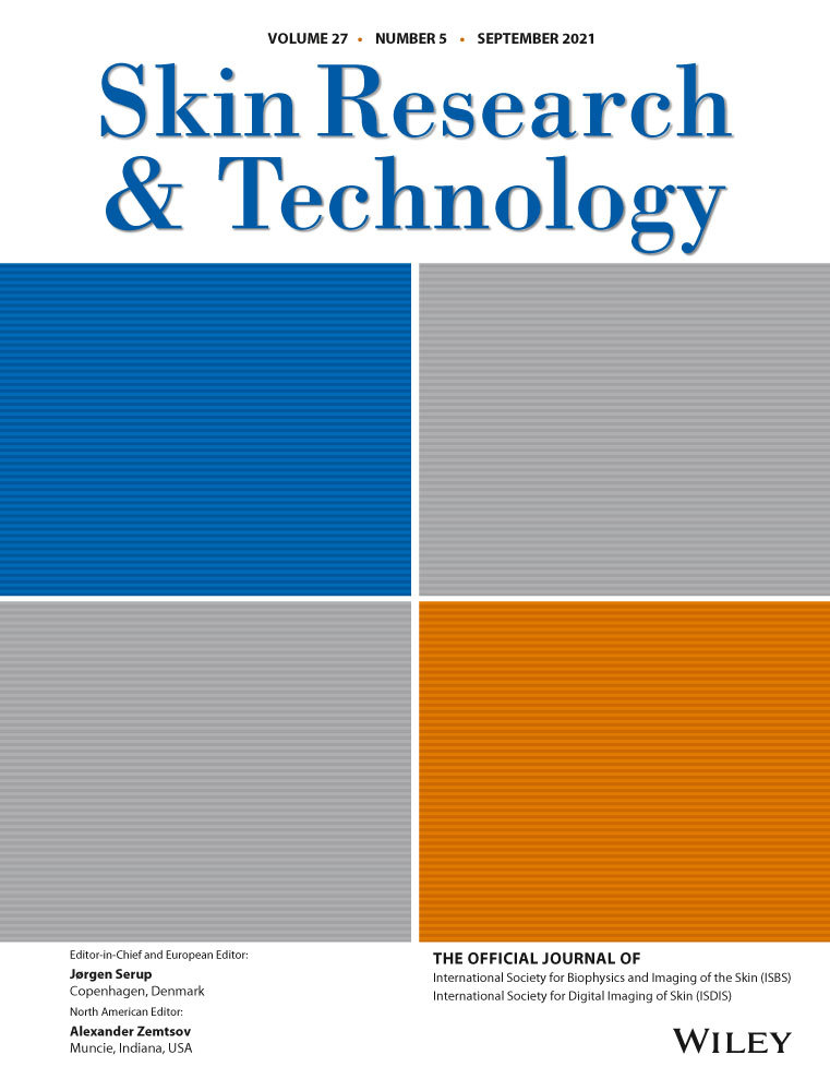 A case of dermatofibrosarcoma protuberans and reflectance confocal microscopy of a post‐surgical skin graft