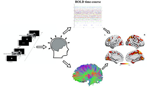 Amygdala network reorganization mediates the theory of mind performances in multiple sclerosis