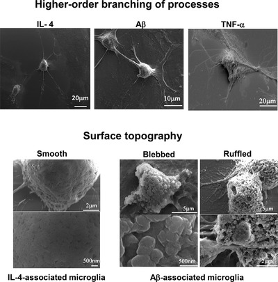 Ultrastructural analysis of the morphological phenotypes of microglia associated with neuroinflammatory cues