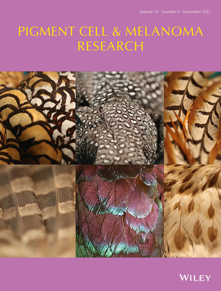 Genetic analysis of multiple primary melanomas arising within the boundaries of congenital nevi depigmentosa