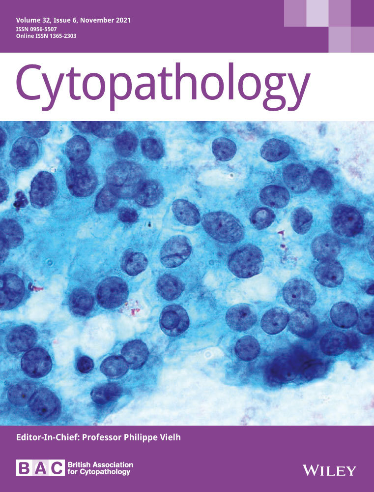 The role of the IAC Yokohama System for Reporting Breast Fine‐Needle Aspiration Biopsy and the ACR Breast Imaging‐Reporting and Data System in the evaluation of breast lesions.