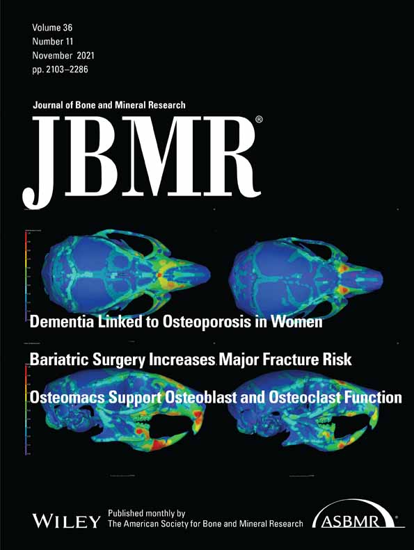 STAT3 hyperactivation due to SOCS3 deletion in murine osteocytes accentuates responses to exercise‐ and load‐induced bone formation