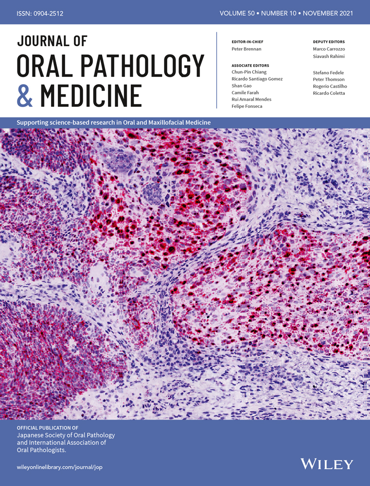 Caveolin‐1 promotes cancer progression via inhibiting ferroptosis in head and neck squamous cell carcinoma