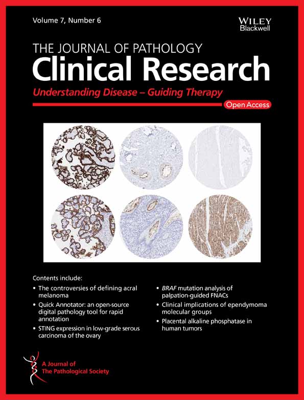 Mismatch repair deficiency in early‐onset duodenal, ampullary, and pancreatic carcinomas is a strong indicator for a hereditary defect
