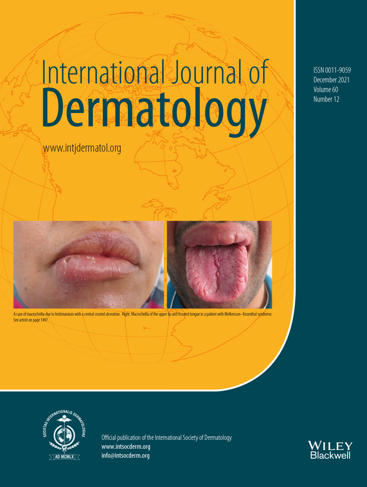 UVA‐1 phototherapy as adjuvant treatment for eosinophilic fasciitis: in vitro and in vivo functional characterization