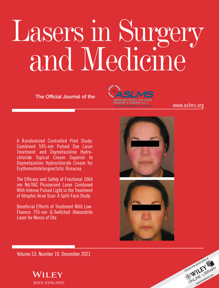 Safety and Efficacy of Nano‐Pulse Stimulation Treatment of Non‐Genital, Cutaneous Warts (Verrucae)