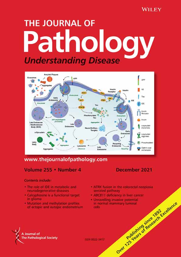 EHMT1 promotes tumor progression and maintains stemness by regulating ALDH1A1 expression in alveolar rhabdomyosarcoma