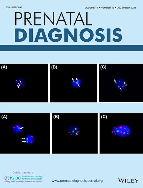 High rate of abnormal findings in Prenatal Exome Trio in low risk pregnancies and apparently normal fetuses