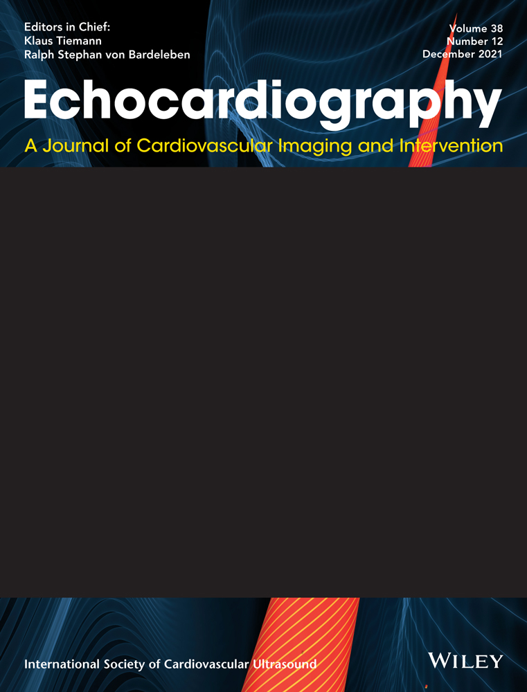 Hemopericardium with cardiac tamponade as a rare presentation of a massive aortic aneurysm in a young child with autosomal recessive cutis laxa