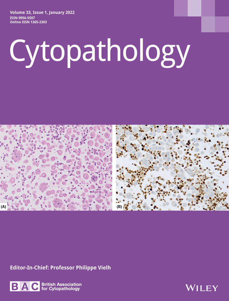 Categorization of Lymph Node Aspirates using the Proposed Sydney System with assessment of Risk of Malignancy and Diagnostic Accuracy