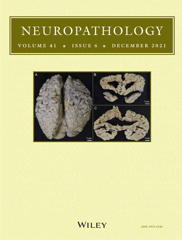 Cotton rats (Sigmodon hispidus) with a high prevalence of hydrocephalus without clinical symptoms