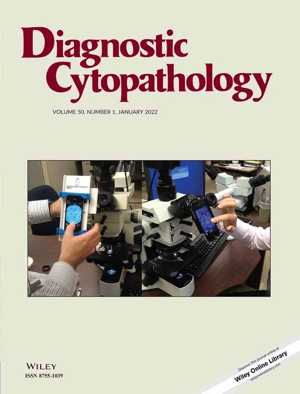 Cytological and histological findings of upper tract mucinous urothelial carcinoma with clear cell component: A case report and review of literature