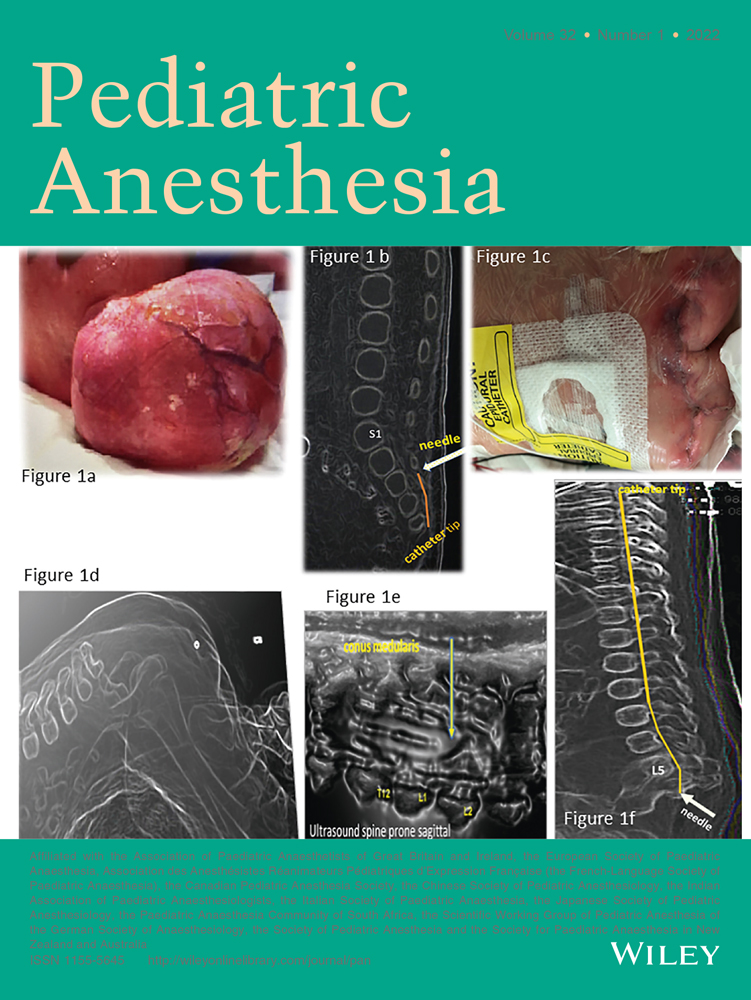 Cystic Fibrosis in Children: A Pediatric Anesthesiologist’s Perspective