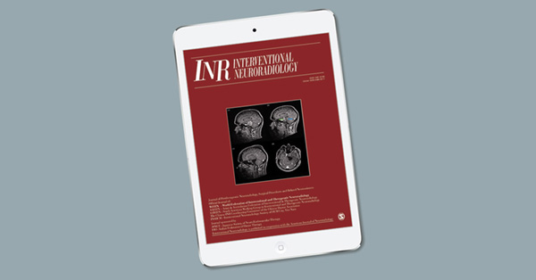 Transvenous embolization of vein of galen aneurysmal malformations using the “Chapot pressure cooker” technique