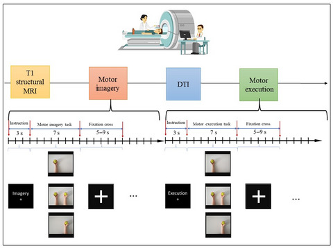 Handedness impacts the neural correlates of kinesthetic motor imagery and execution: A FMRI study