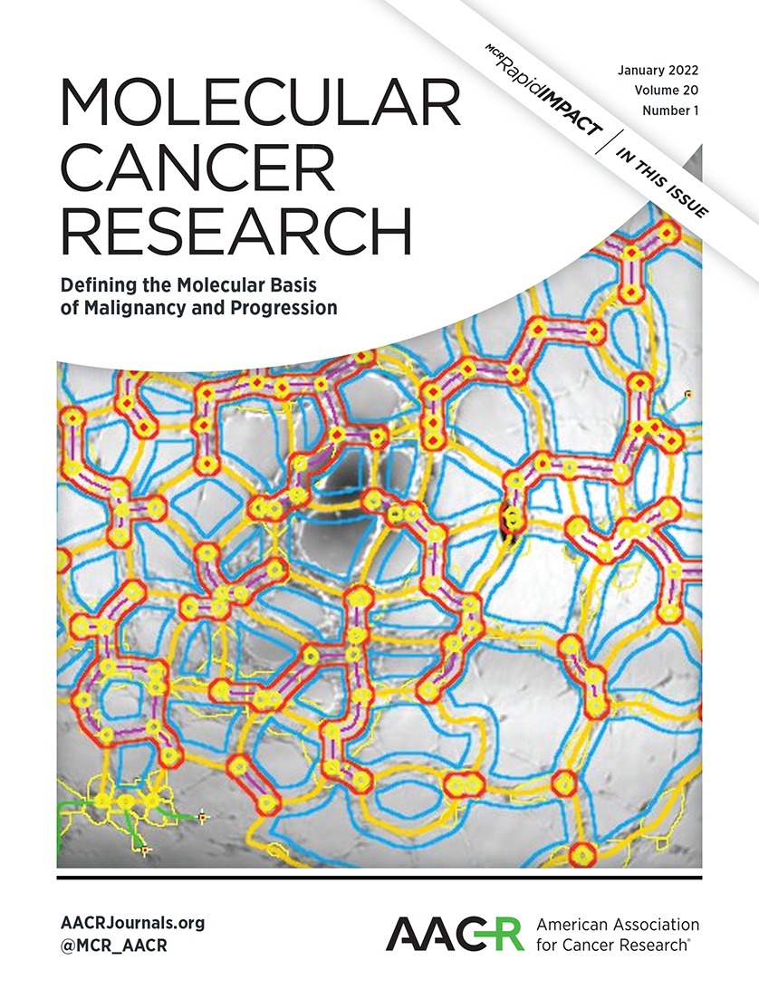 Oncogenic Activity of Glucocorticoid Receptor {beta} Is Controlled by Ubiquitination-Dependent Interaction with USP49 in Glioblastoma Cells