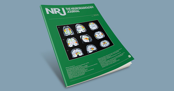 Temporal pole blurring in temporal lobe epilepsy revealed by 3D Edge-Enhancing Gradient Echo MRI