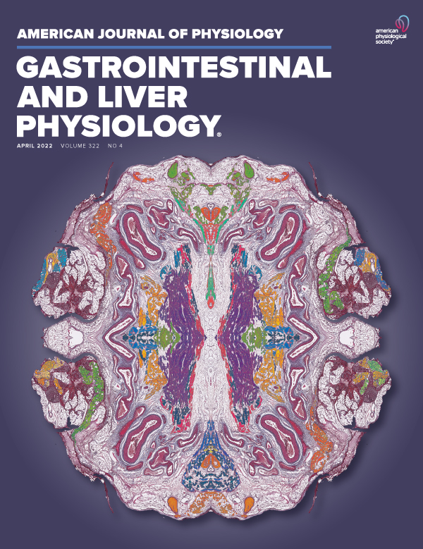 Hepatocyte- or macrophage-specific SREBP-1a deficiency in mice exacerbates methionine- and choline-deficient diet-induced nonalcoholic fatty liver disease