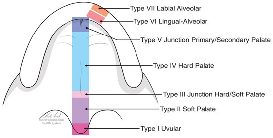 JPM, Vol. 13, Pages 65: Evaluation of a Novel Technique for Closure of Small Palatal Fistula