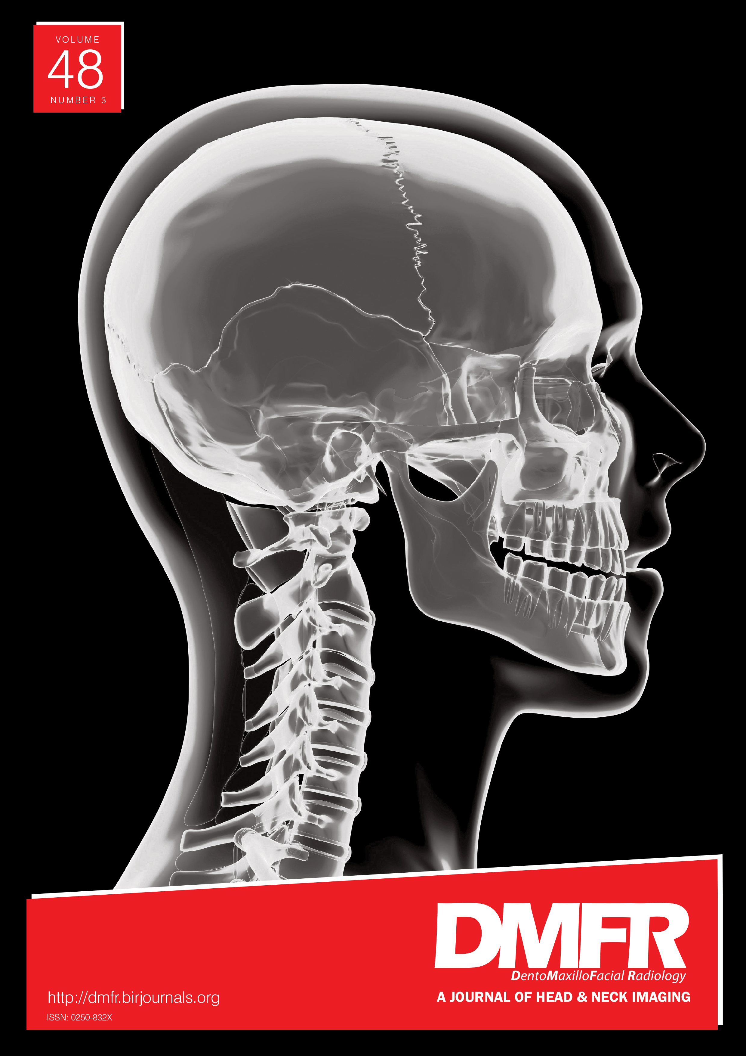 The magnetic resonance imaging characteristics of radicular cysts and granulomas
