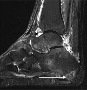 Imaging of Rheumatological Disorders