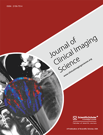 Lemmel syndrome, a rare cause of obstructive jaundice by periampullary duodenal diverticulum: Case report and review of the literature