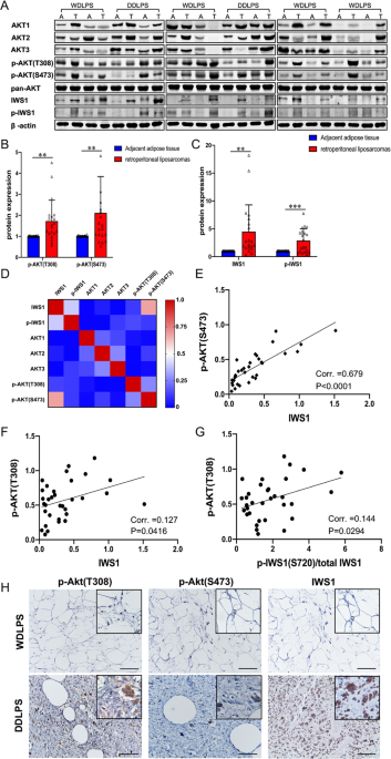 Phosphorylation of IWS1 by AKT maintains liposarcoma tumor heterogeneity through preservation of cancer stem cell phenotypes and mesenchymal-epithelial plasticity