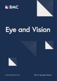 Comparison of corneal aberrations from anterior segment swept source OCT versus Placido-topography combined spectral domain OCT in cataract patients