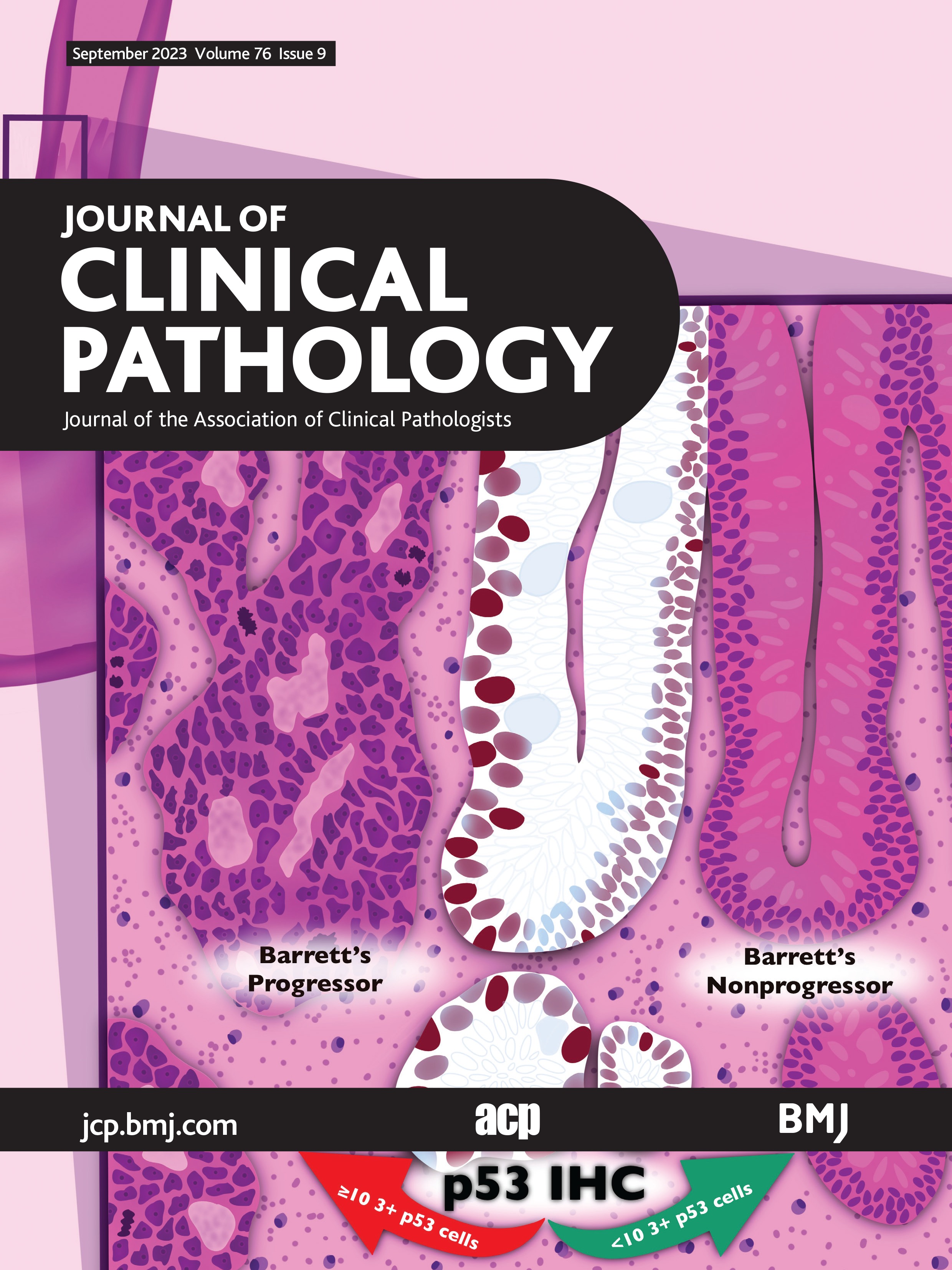 Implementation of the updated NICE haematological cancers (NG47) improving outcomes guidelines across Specialist Integrated Haematological Malignancy Diagnostic Services (SIHMDS) in England: a UK NEQAS LI survey