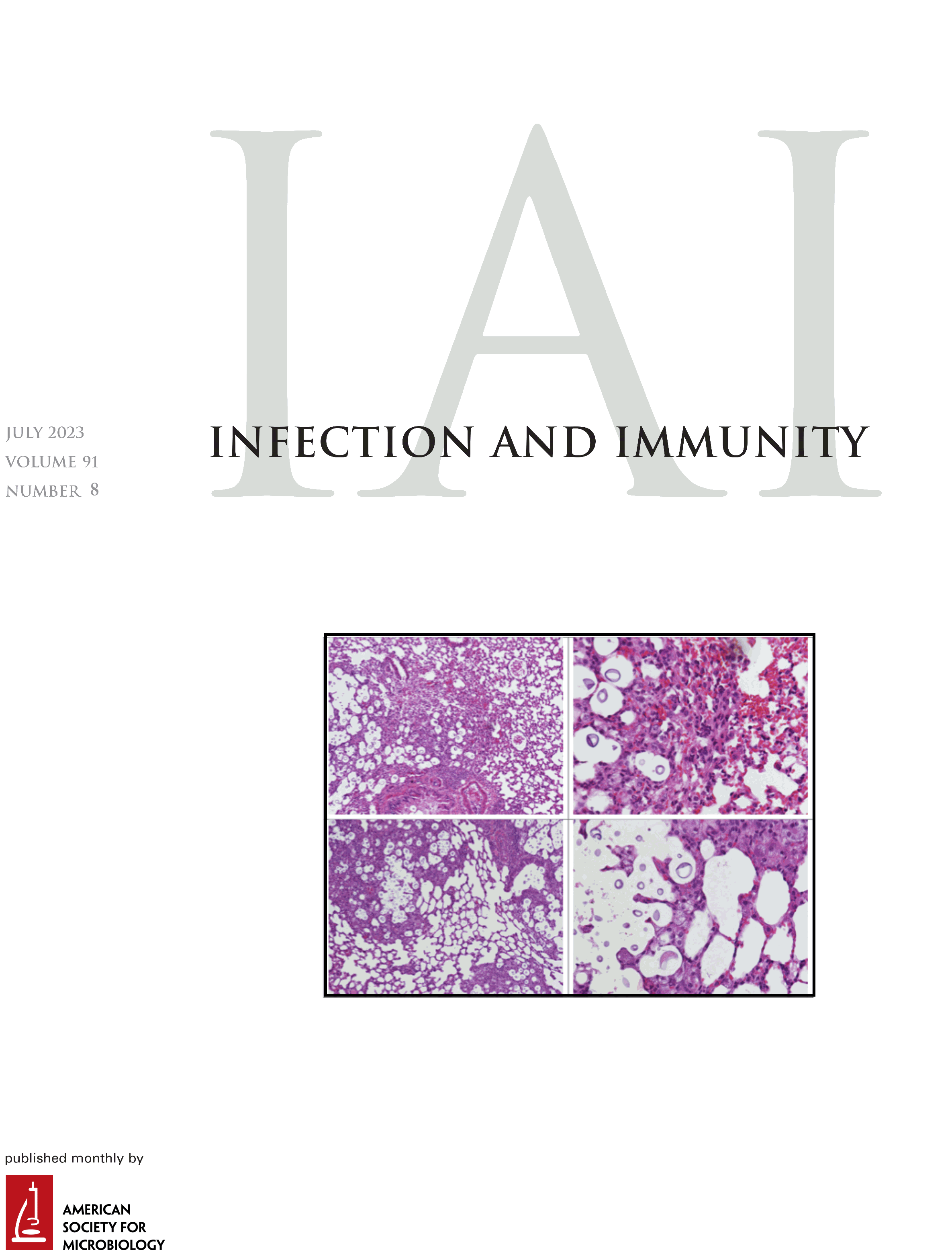 Fusobacterium nucleatum Promotes Megakaryocyte Maturation in Patients with Gastric Cancer via Inducing the Production of Extracellular Vesicles Containing 14-3-3ε