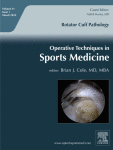 Unstable Knee OCD Lesion Fixation with Bioabsorbable Fixation