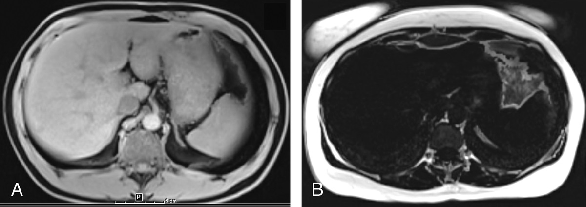 Performing Quality Control on Magnetic Resonance Imaging Liver Fat/Iron Quantification Studies: A Critical Requirement