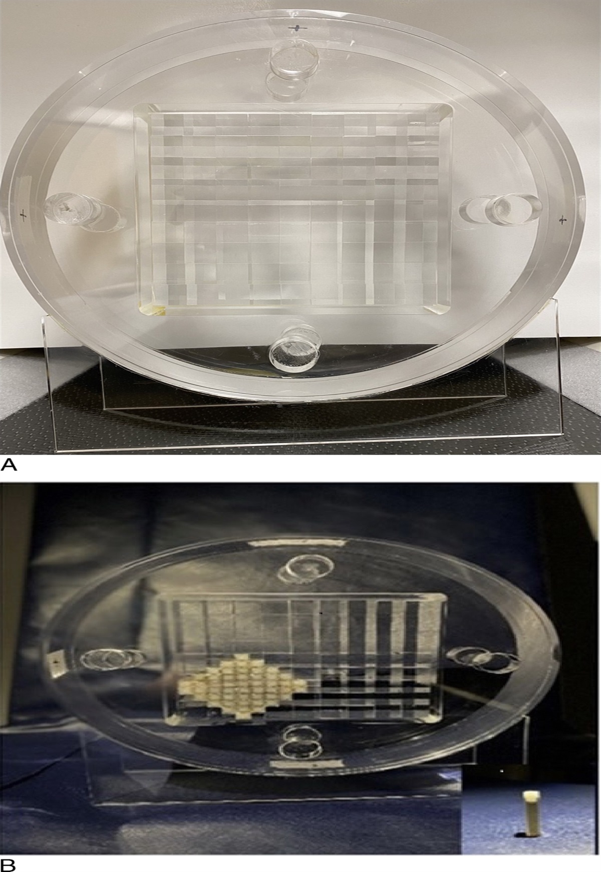 Quantitative Assessment of Lipiodol-Related Artifact Reduction for Dual-Energy Computed Tomography After Transcatheter Arterial Chemoembolization: A Phantom Study Evaluating the Use of Metal Artifact Reduction Algorithms