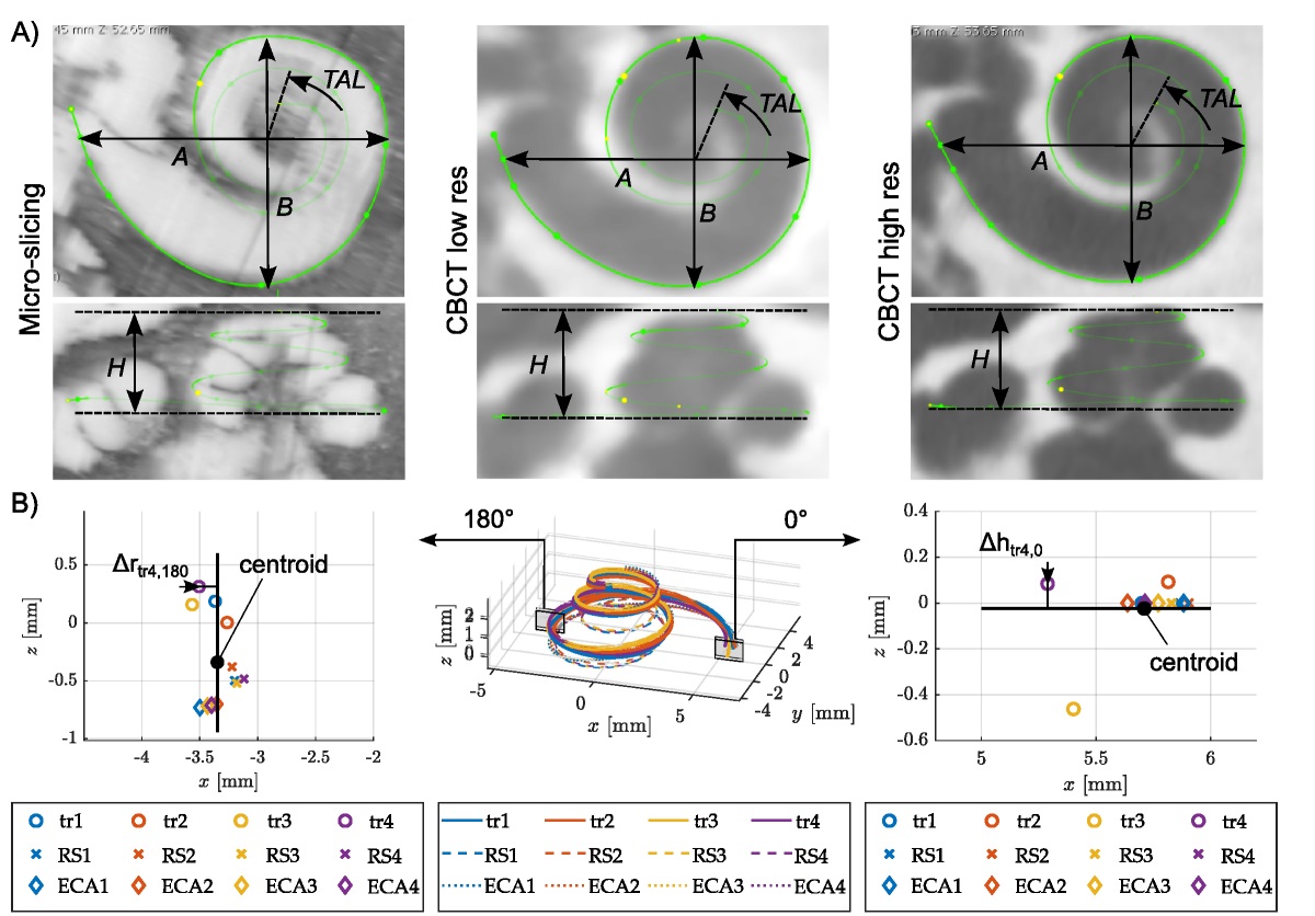 The Dependency of Cochlear Lateral Wall Measurements on Observer and Imaging Type