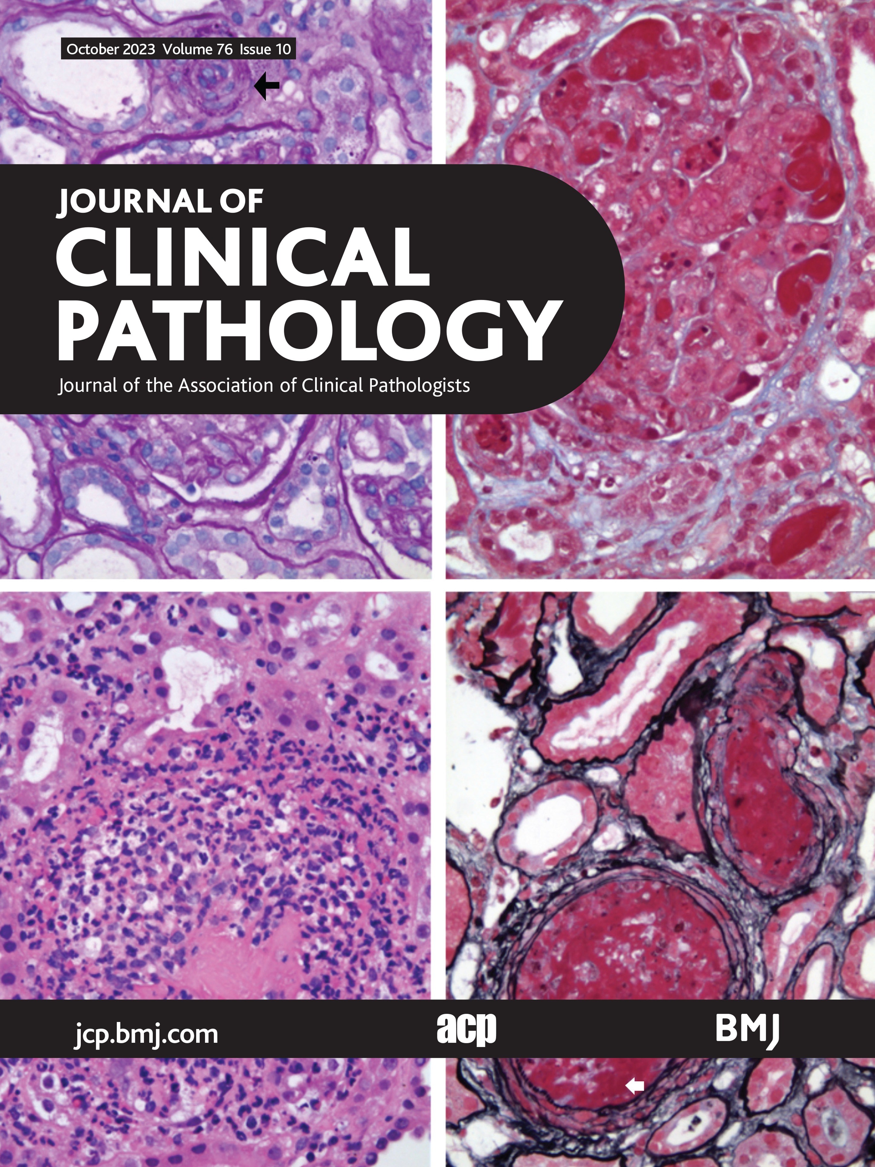 Cost analysis of archives in the pathology laboratories: from safety to management