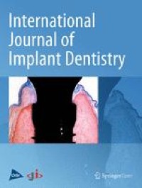Impact of implant location on load distribution of implant-assisted removable partial dentures: a review of in vitro model and finite-element analysis studies