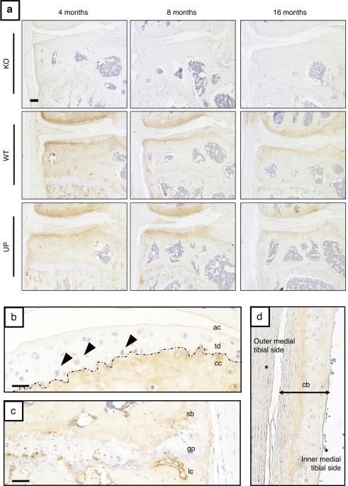 Osteomodulin downregulation is associated with osteoarthritis development