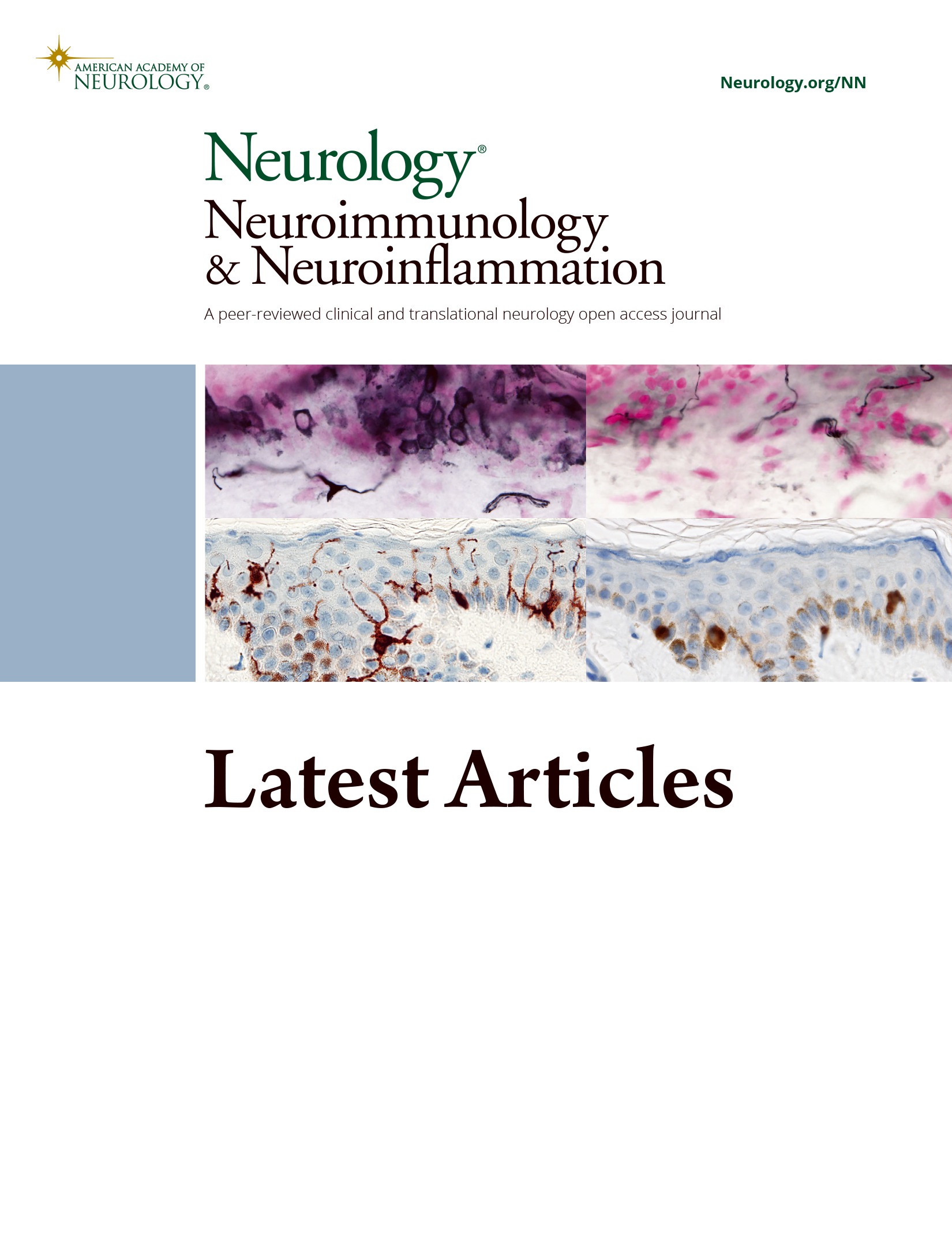 Multiple Sclerosis, Disease-Modifying Therapies, and Infections