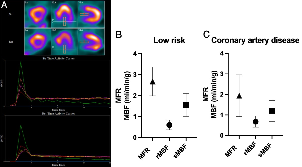 Dynamic CZT-SPECT: Characterizing the Lower Values of Myocardial Blood Flow and Reserve