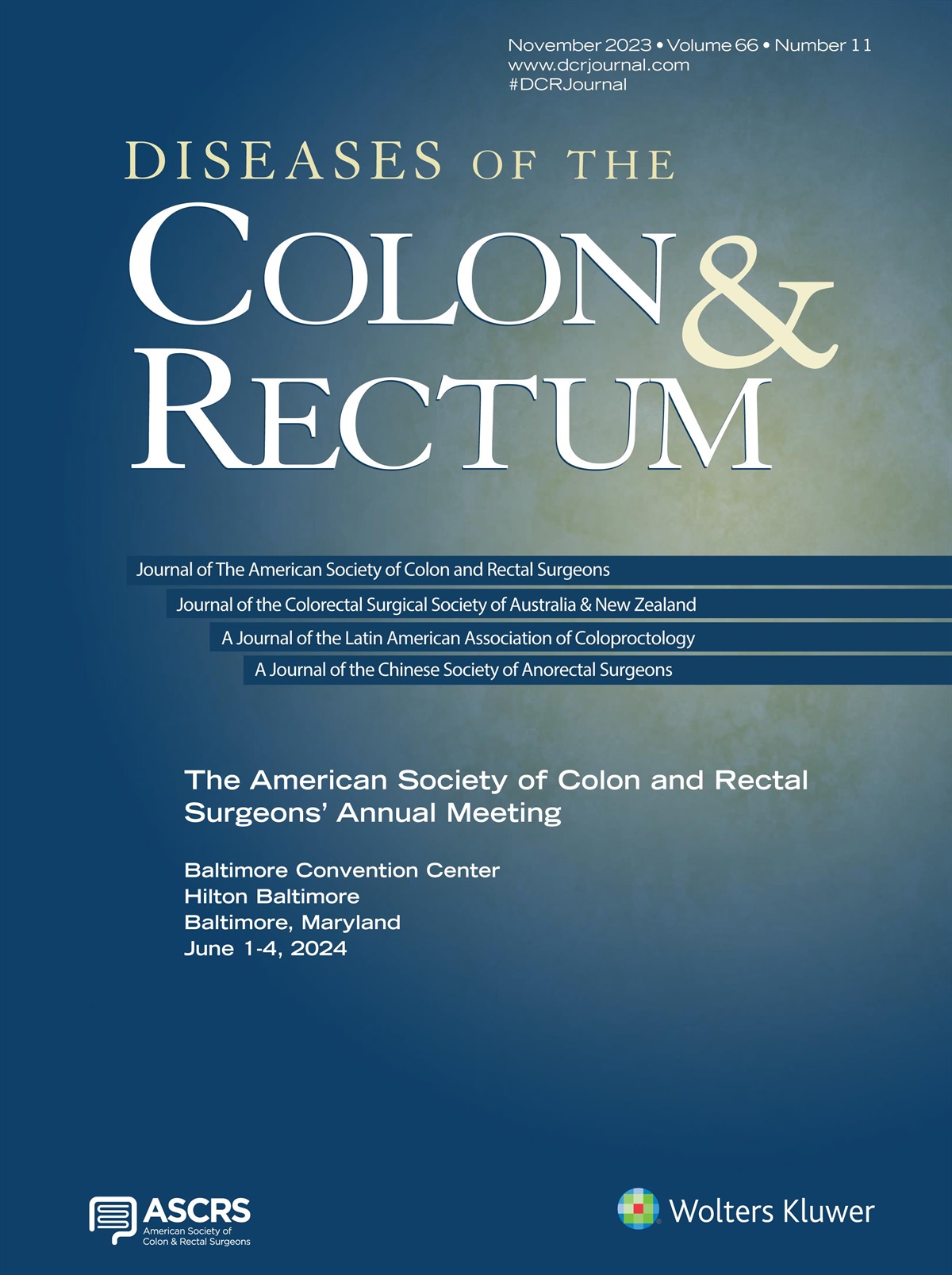 Accessory Middle Colic Artery-Preserving Laparoscopic Splenic Flexure Mobilization With Articulated Laparoscopic Instrument