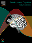 Combined multi-session transcranial alternating current stimulation (tACS) and language skills training improves individual gamma band activity and literacy skills in developmental dyslexia