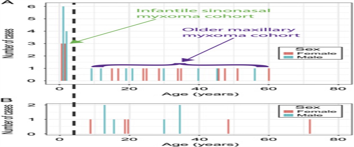 Infantile Sinonasal Myxoma Is Clinically and Genetically Distinct From Other Myxomas of the Craniofacial Bones and From Desmoid Fibromatosis
